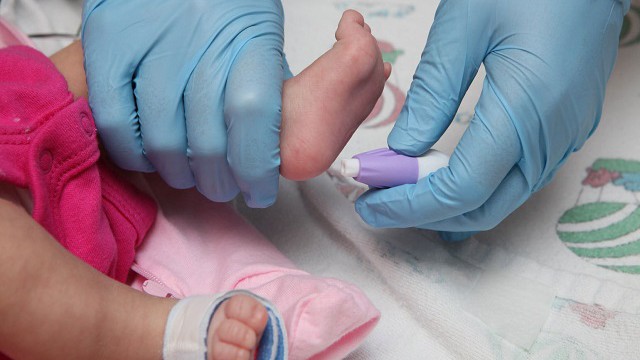 foto_screening neonatale