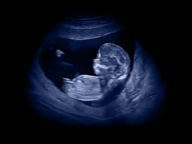 ecografia-prenatale