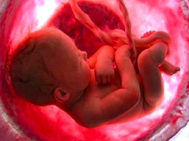 feto-placenta