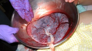 foto_placenta