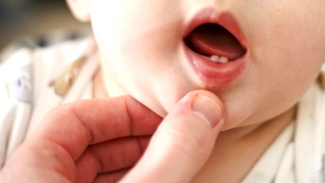 denti neonato