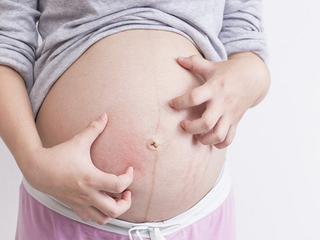 prurito in gravidanza