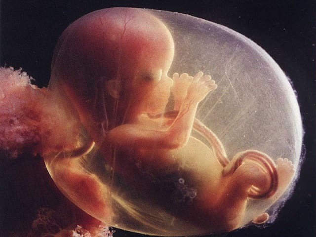 feto 15 settimane
