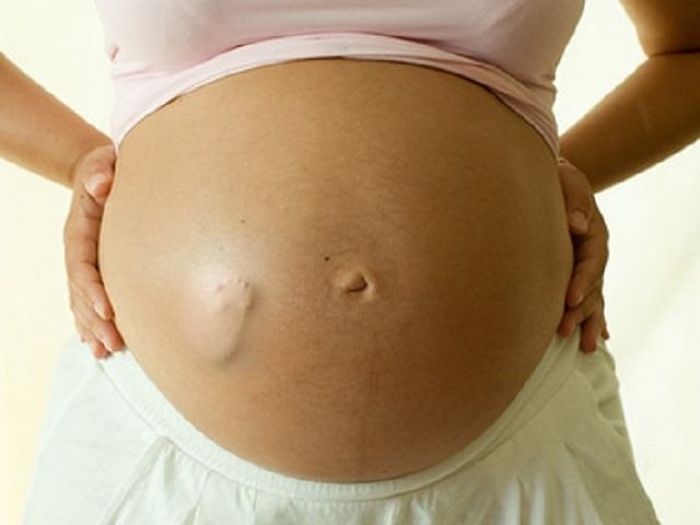 pancia asimmetrica in gravidanza