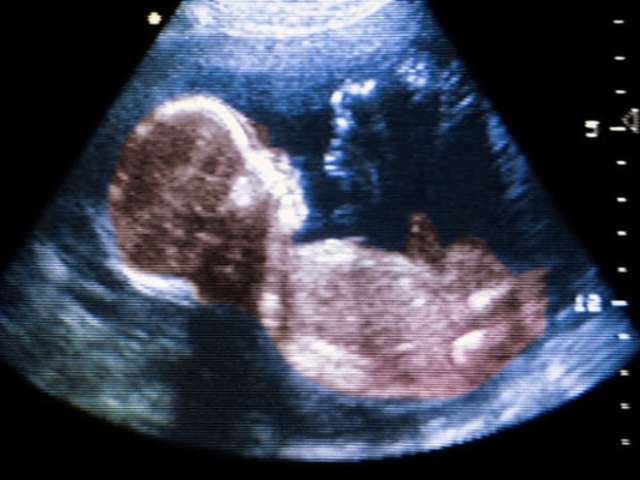 feto a 5 mesi