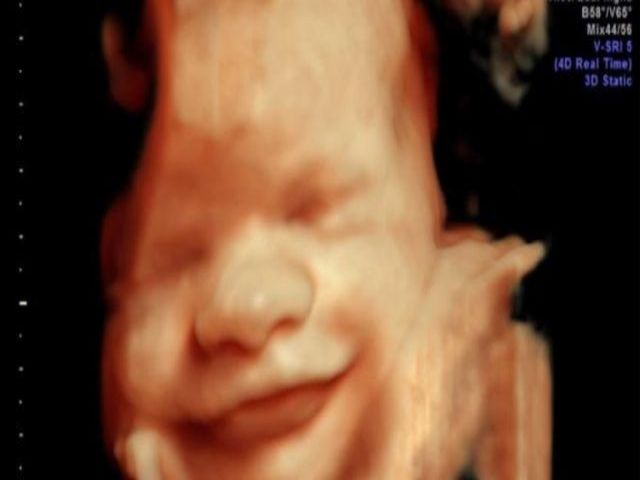 feto sorridente