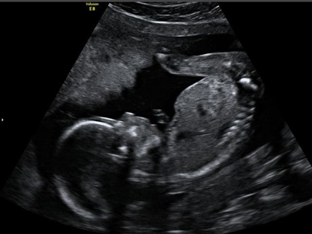 foto 19 settimana di gravidanza